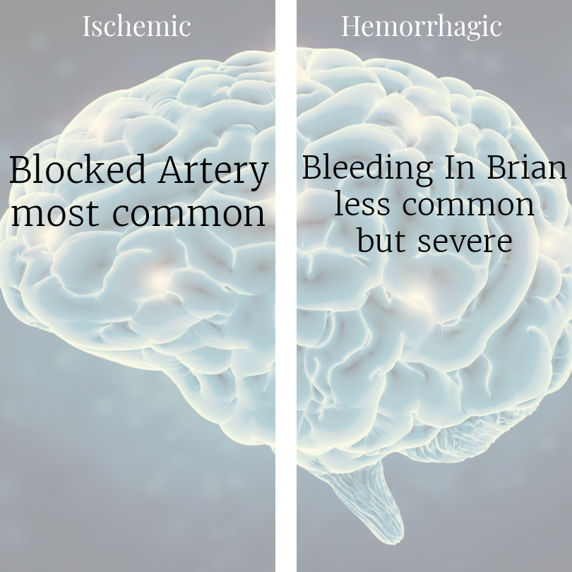 Ischemic vc Hemorrhagic