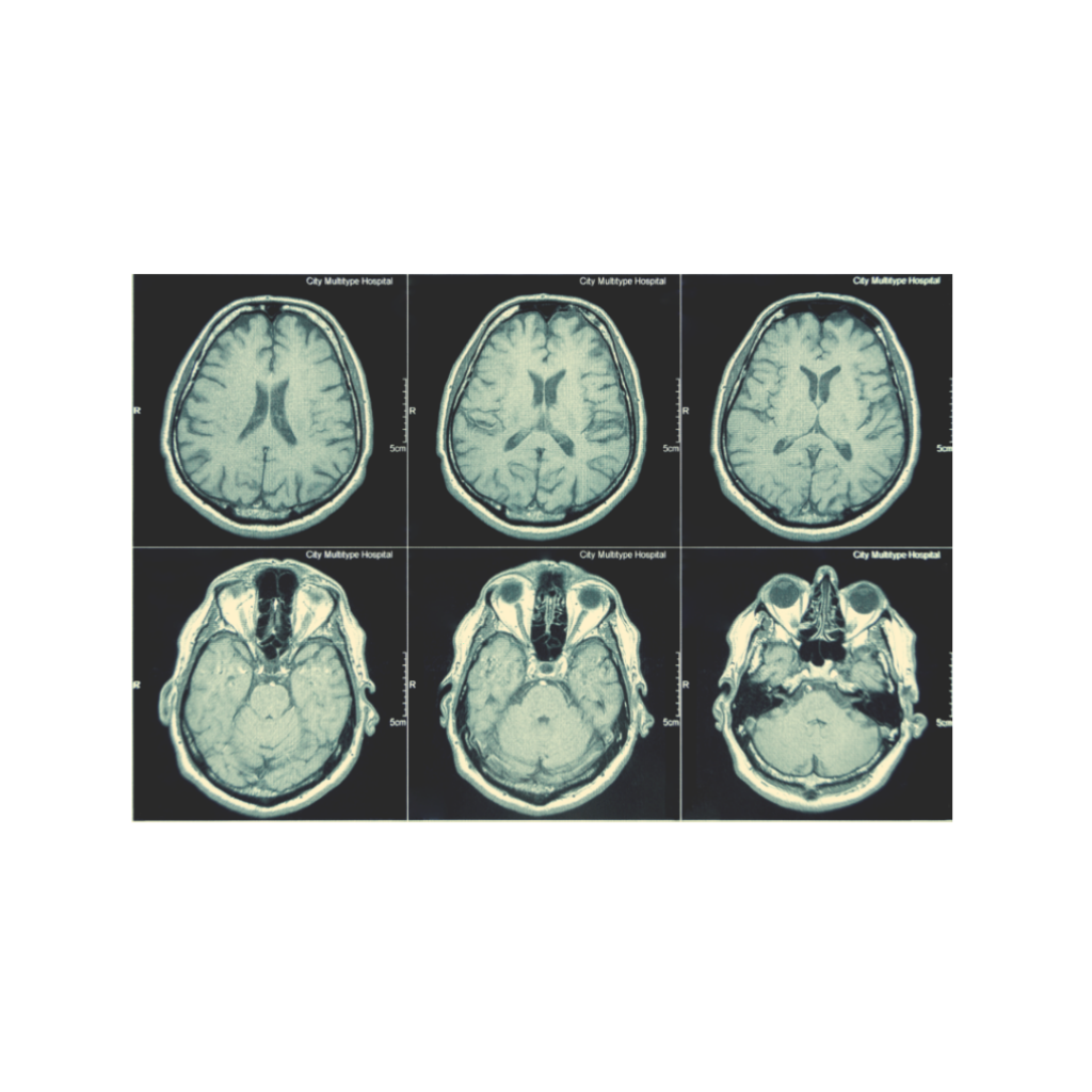 Brain Scan