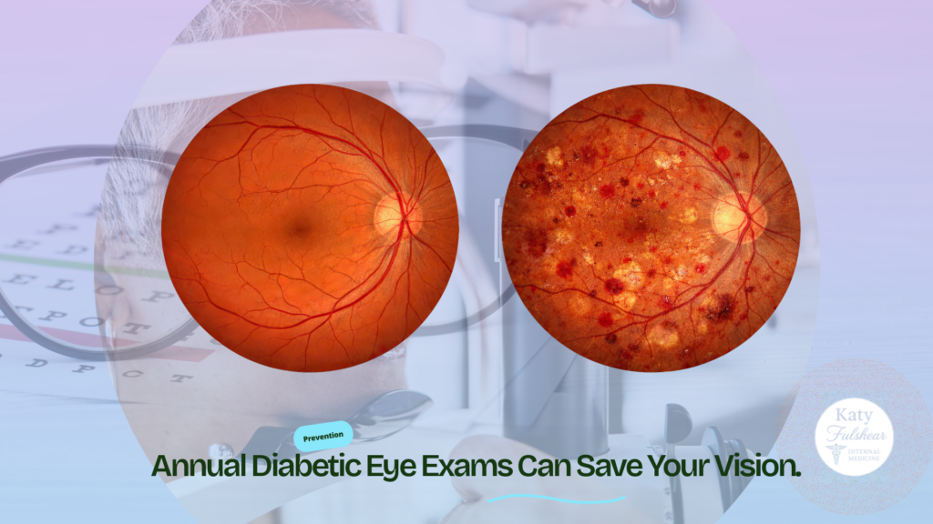 Diabetic Eye Exam