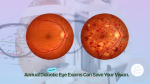 Diabetic Eye Exam