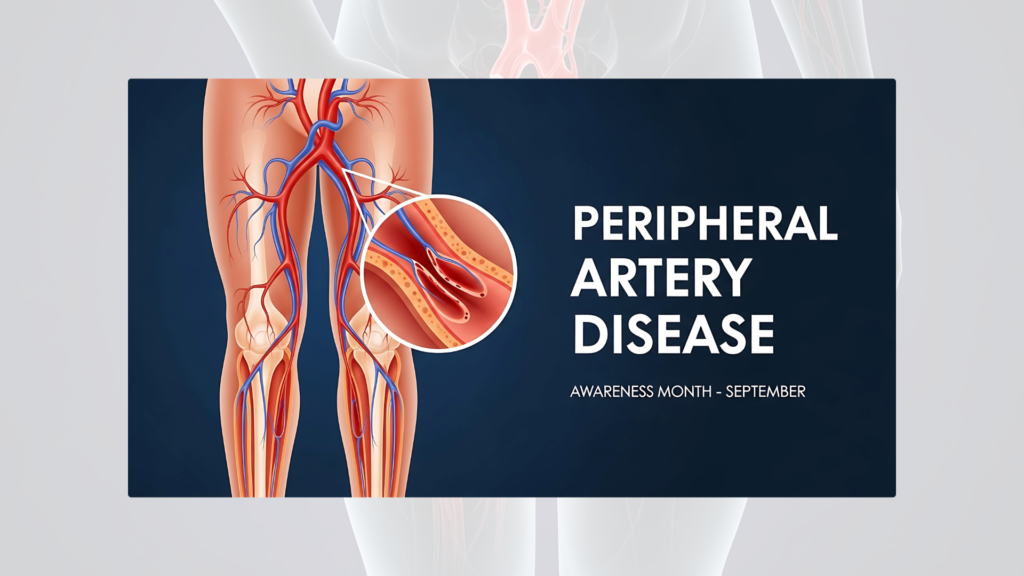 peripheral arterial disease