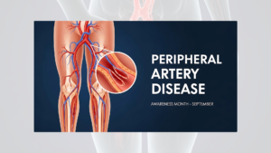 peripheral arterial disease